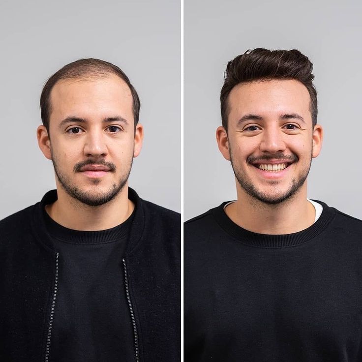 Guzel Hair Growth Combo Oil+Capsules